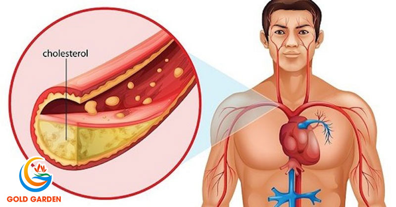 Sữa Cho Người Mỡ Máu Cao